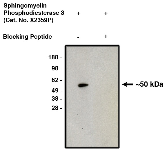 "
Western blot using affinity purified nSMase2 antibody (Cat. No. X2359P) on human brain lysate (Cat. No. X1633C).  Antibody without (lane 1) or with (lane 2) blocking peptide.  Visualized using mouse anti-rabbit HRP conjugated (Cat. No. X1207M) at 1:200K dilution)."